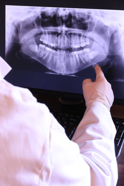 Best Emergency Dentist for Knocked-Out Tooth in Cleburne, TX