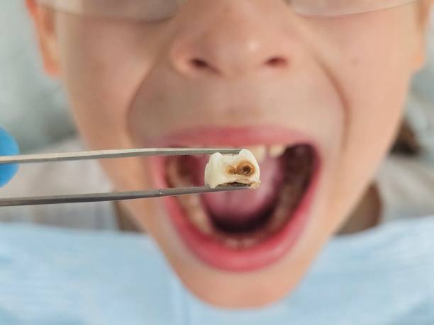 Best Emergency Dental Services for Seniors in Cleburne, TX